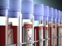 В Африке испытывают принципиально новый препарат для лечения ВИЧ-инфекции